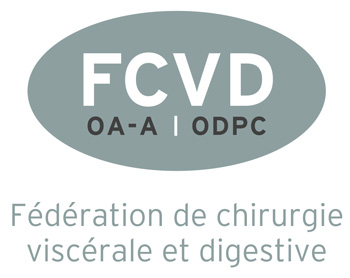 FCVD